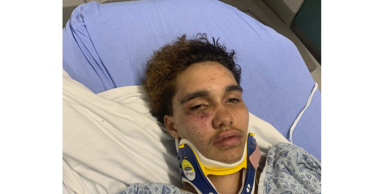 A transgender teen in Massachusetts says other high schoolers beat him at a party