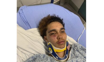 A transgender teen in Massachusetts says other high schoolers beat him at a party